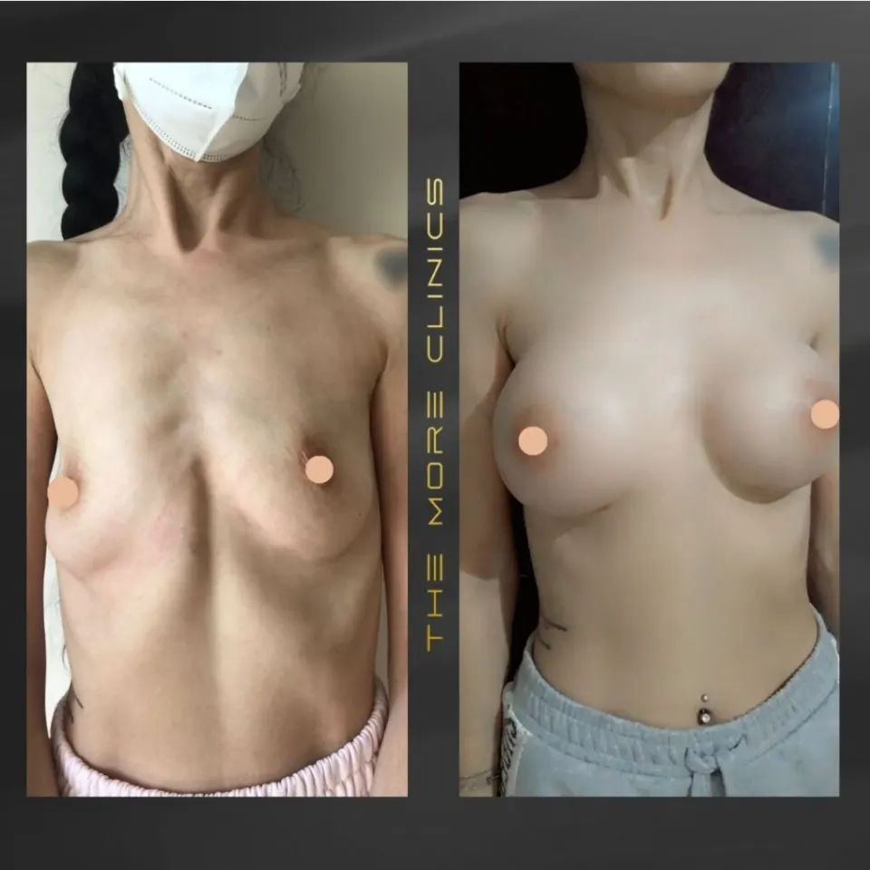 Aesthetic-surgery results 6