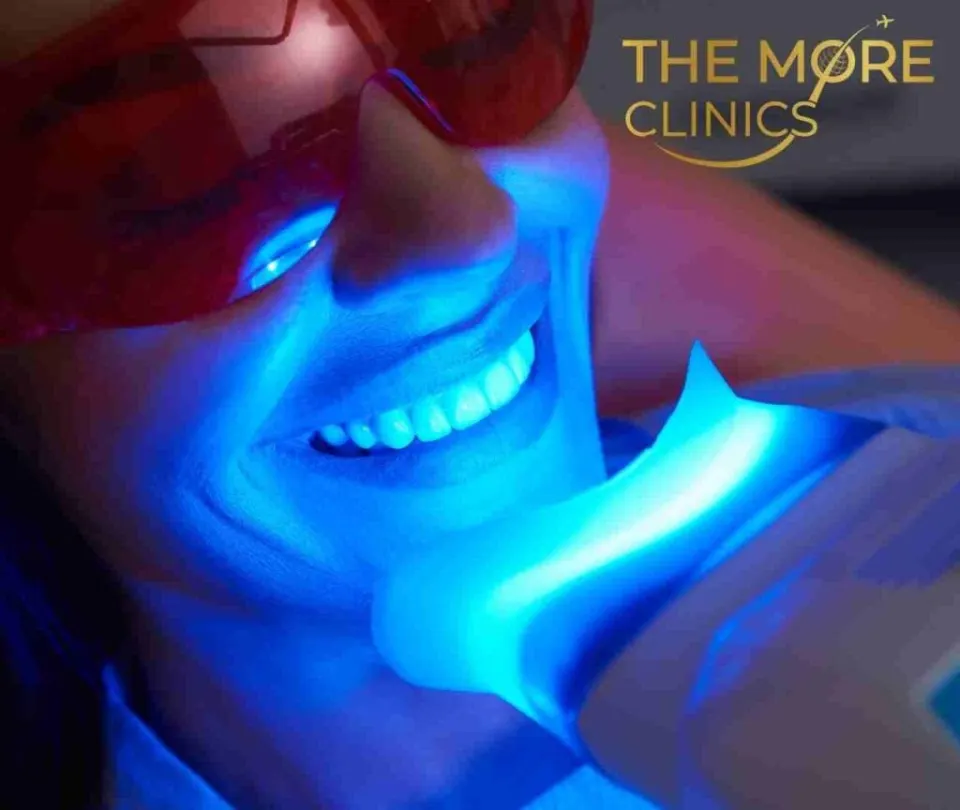 Zähne bleaching laser