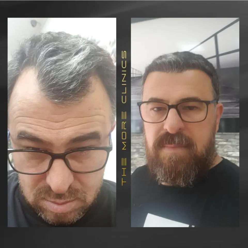 Hair before & after 22