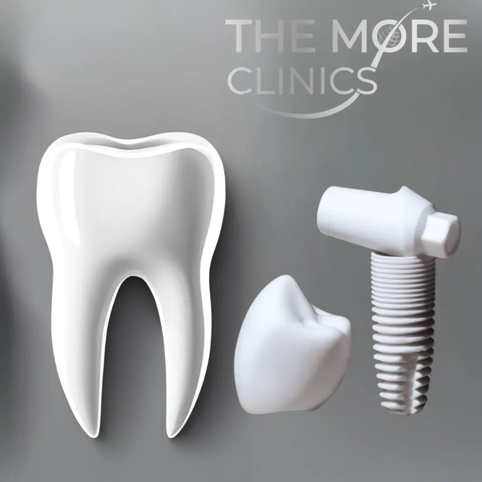 zirconium implants treatments in Turkey