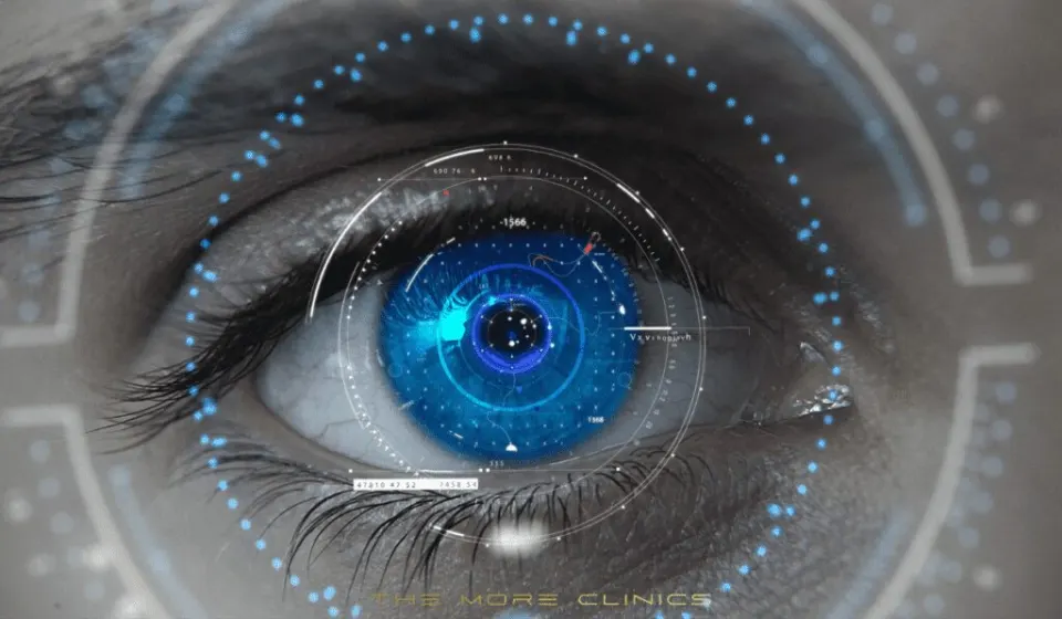 Chirurgie oculaire iLASIK Turquie