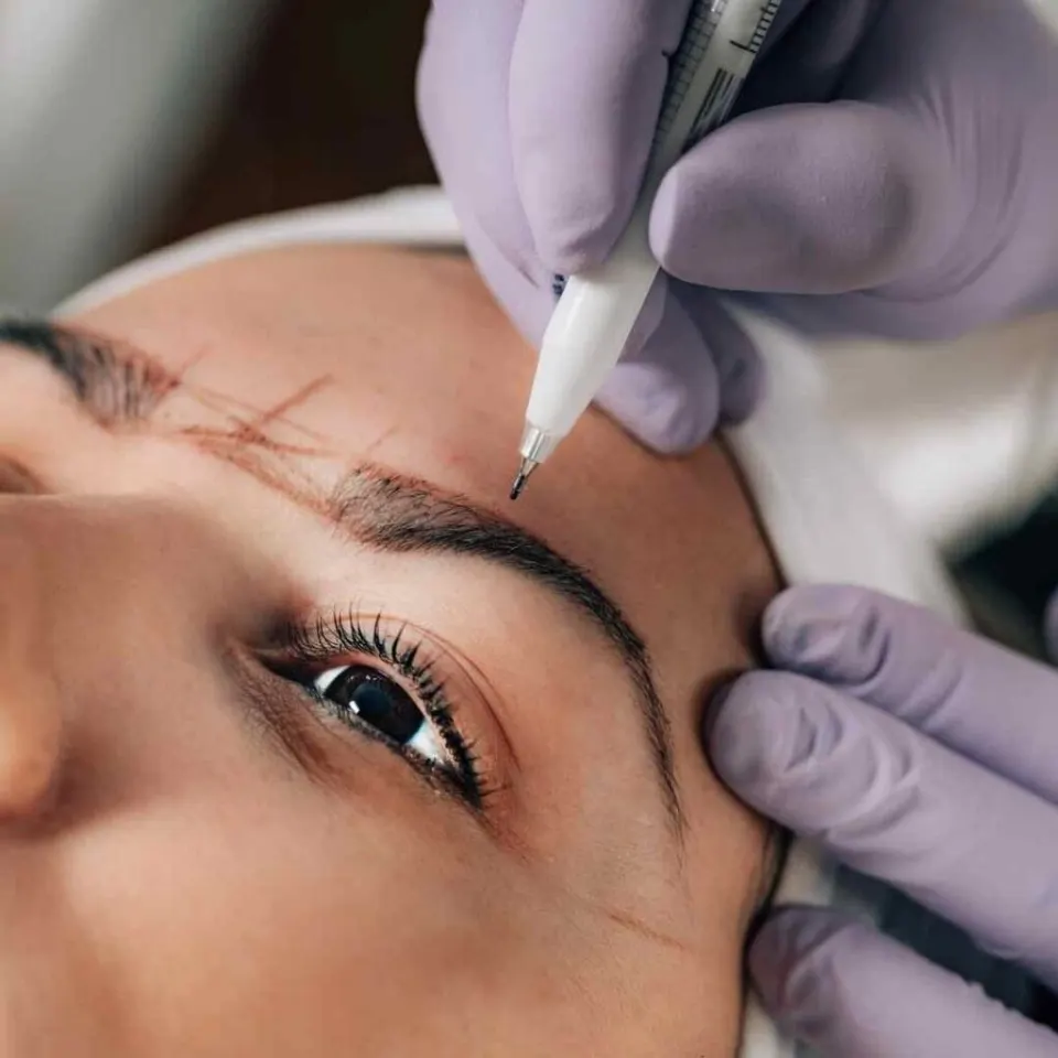 Eyebrow transplant Antalya Turkey — patient experience The More Clinics