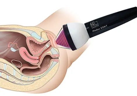 Vaginal Procedures Turkey