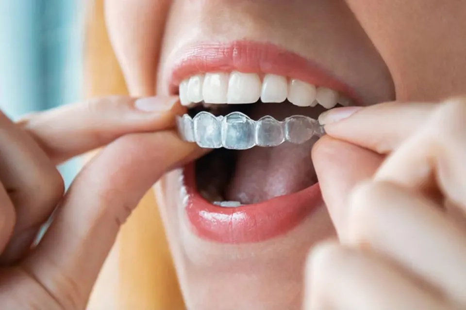 Antalya Invisalign treatment