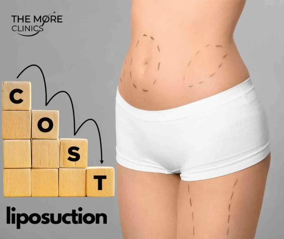 fettabsaugung kosten türkei