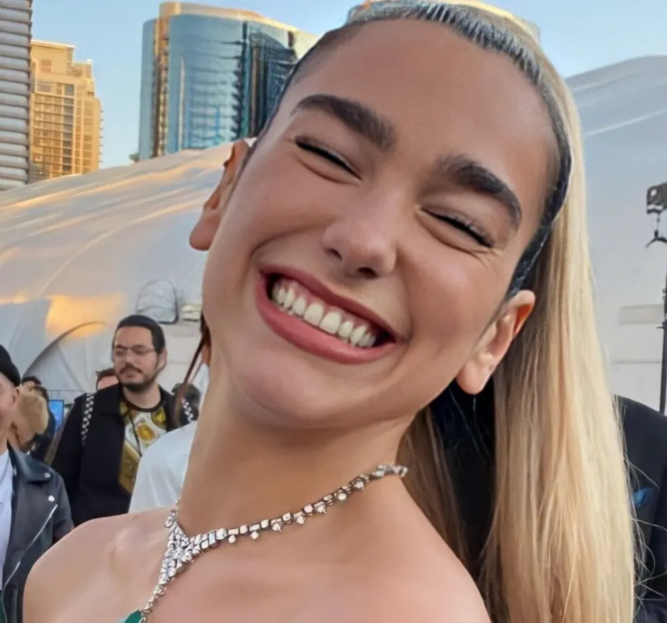 Dua Lipa Teeth Before After