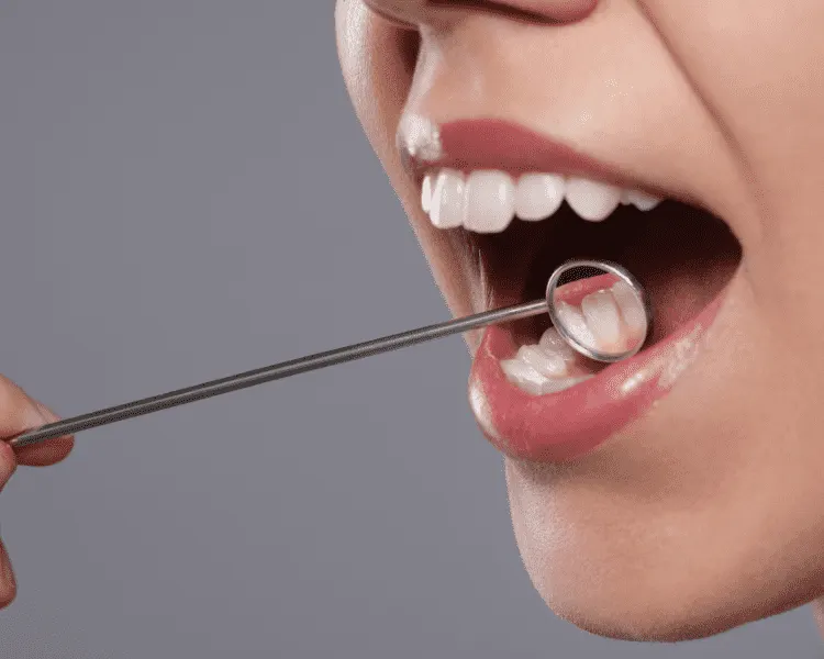 Periodontitis treatment — scaling root planing surgery bone graft