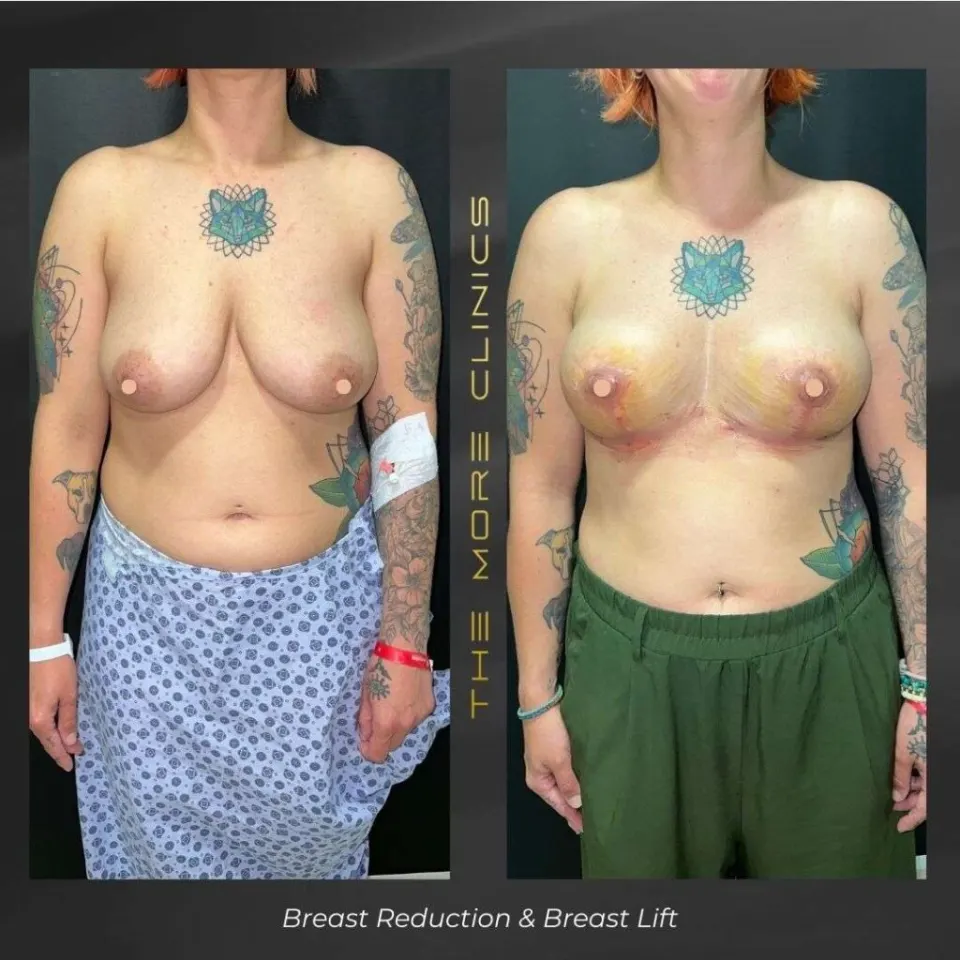 Aesthetic before & after 15