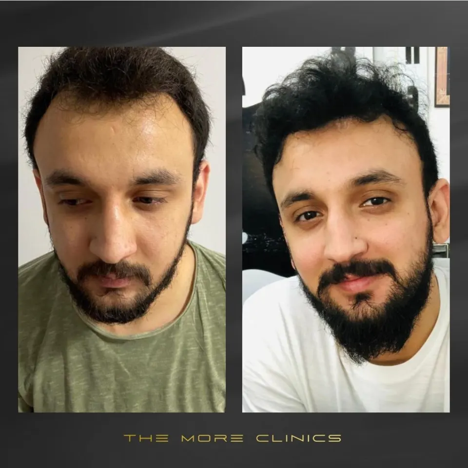 Hair before & after 16