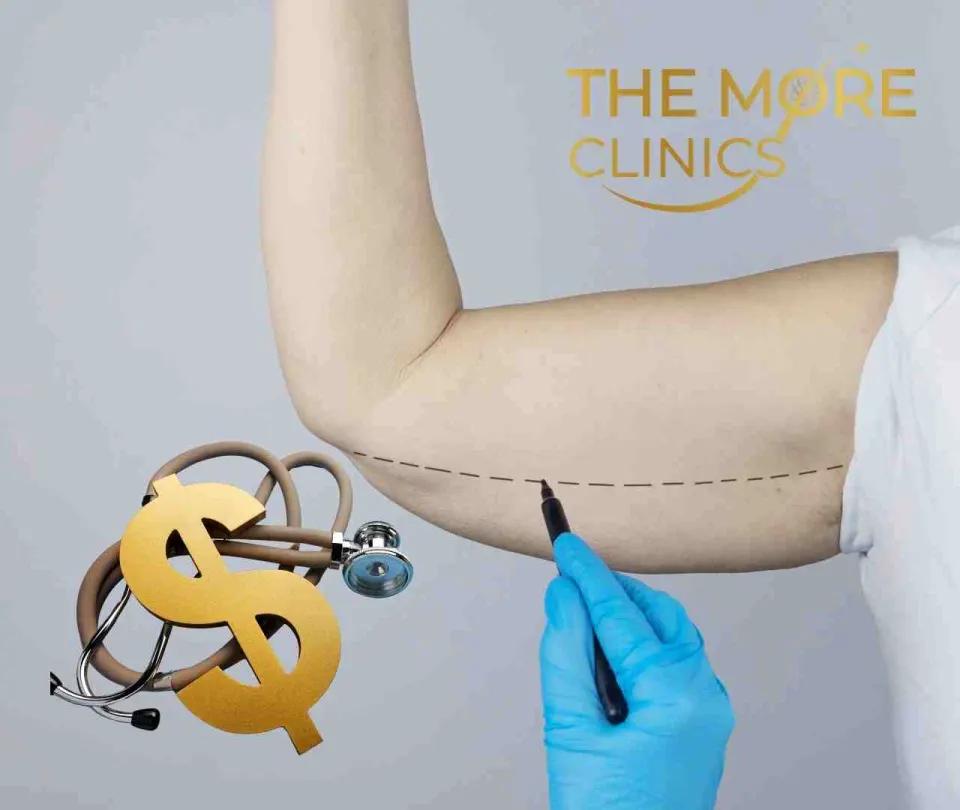 brachioplasty cost of arm lift