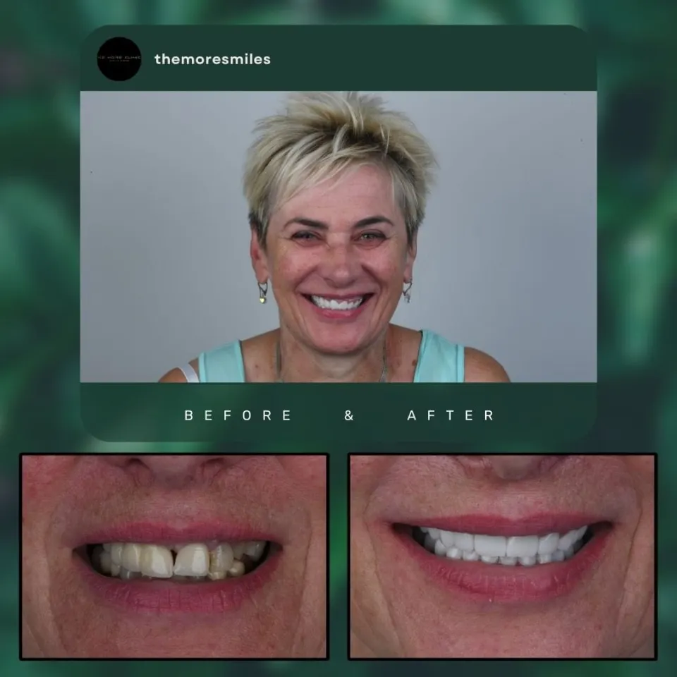 Dental before & after 47