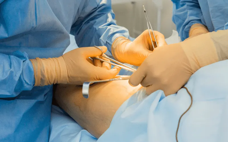 bone marrow transplant as cancer treatment