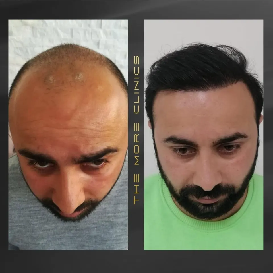 Hair before & after 14