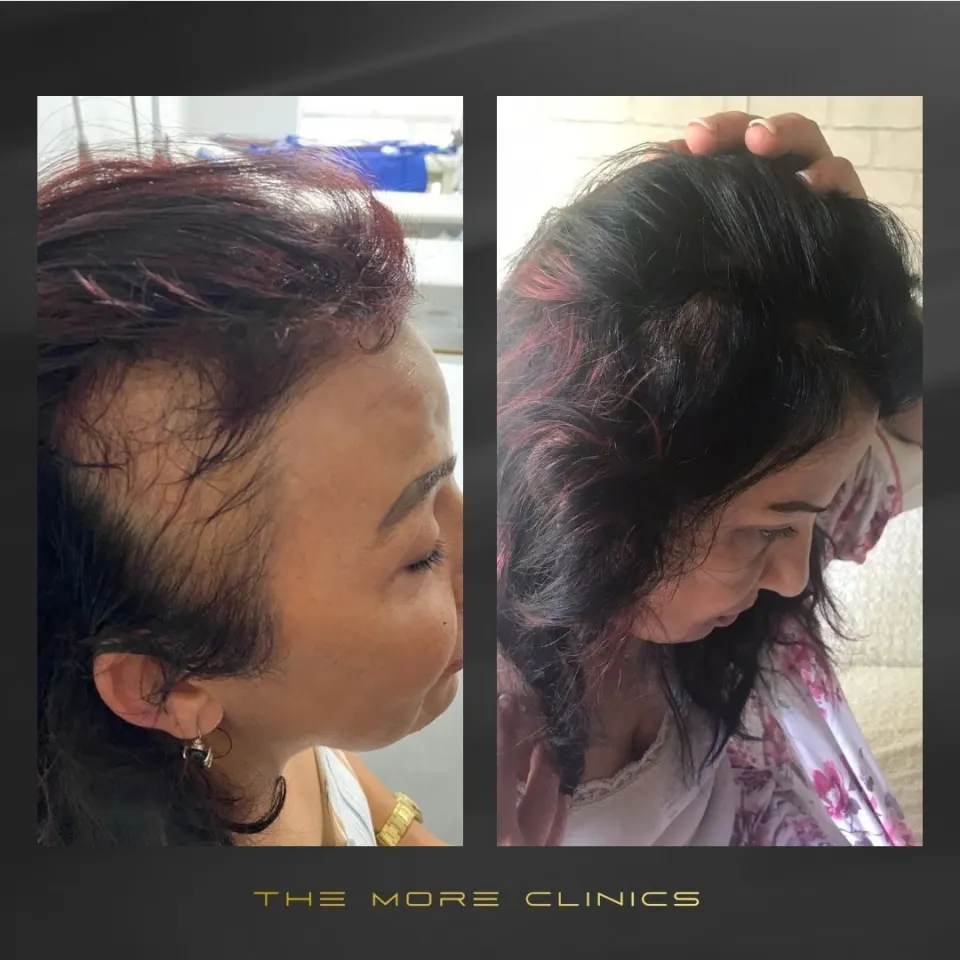 Hair before & after 33