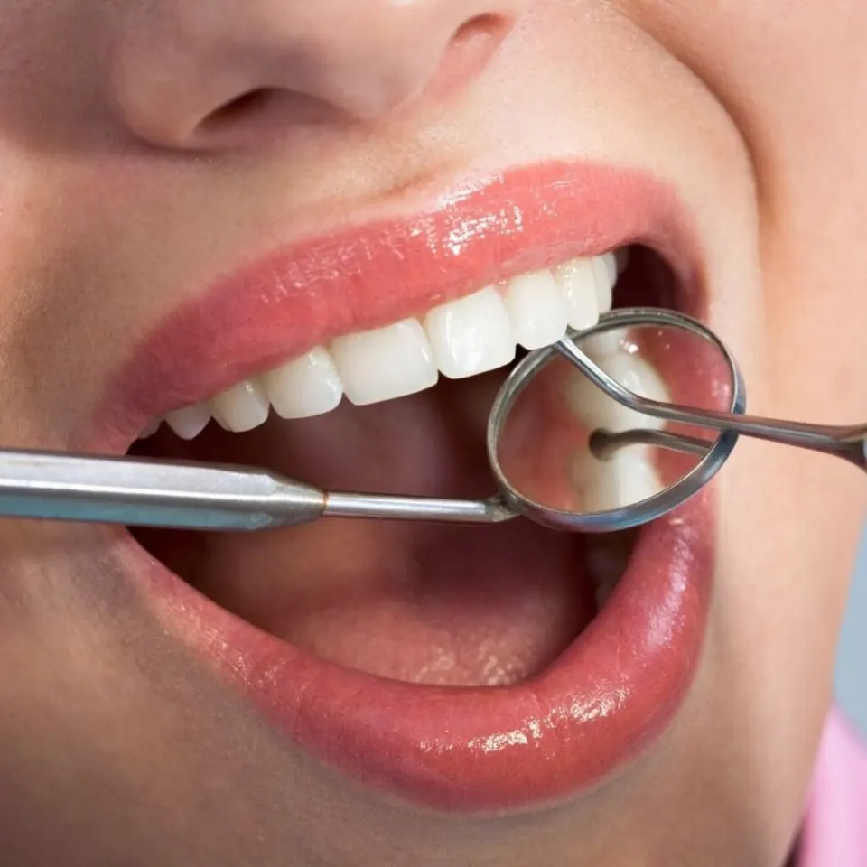 Dental Crowns in Turkey: Cost, Types