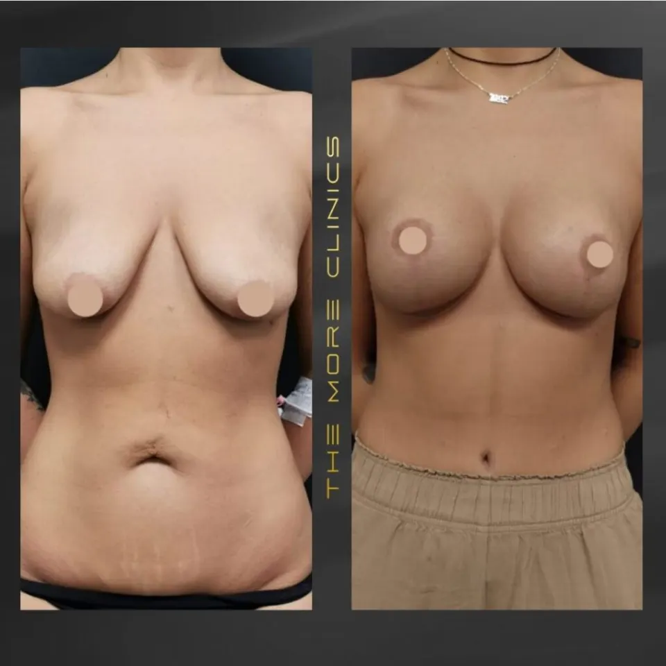 Aesthetic-surgery results 5