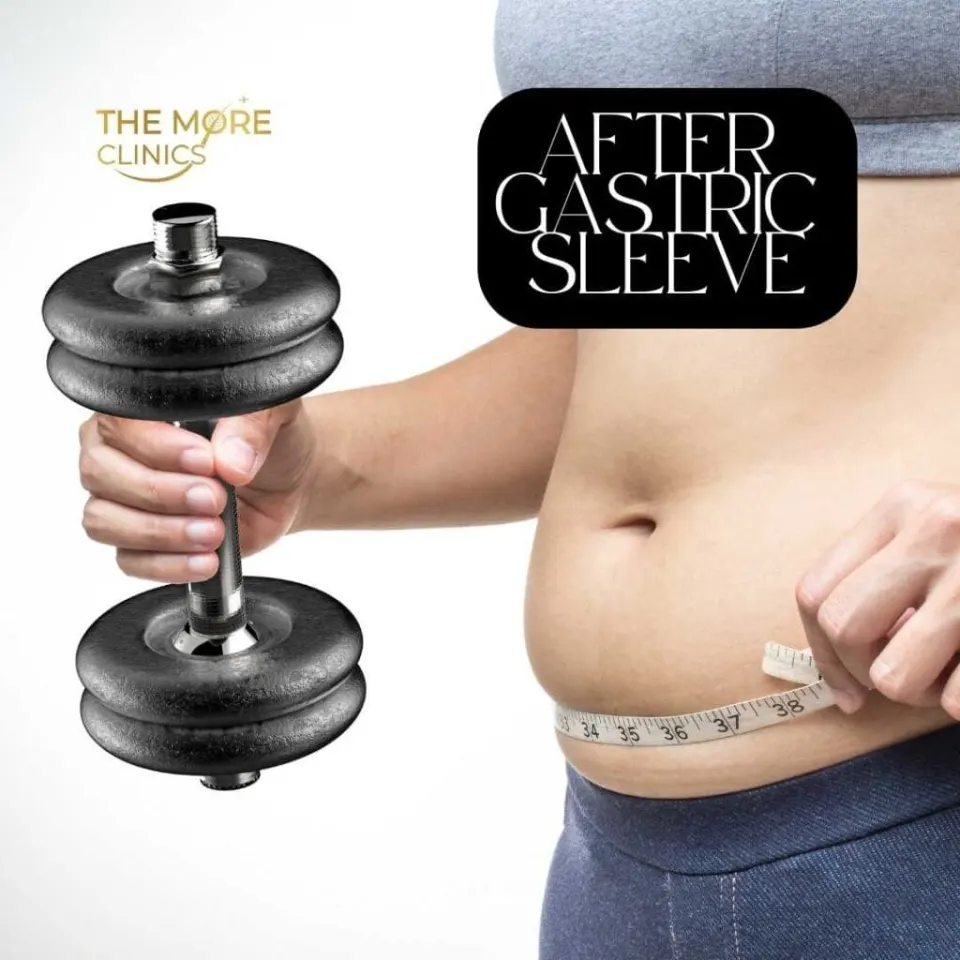 RECOVERY from gastric sleeve surgery