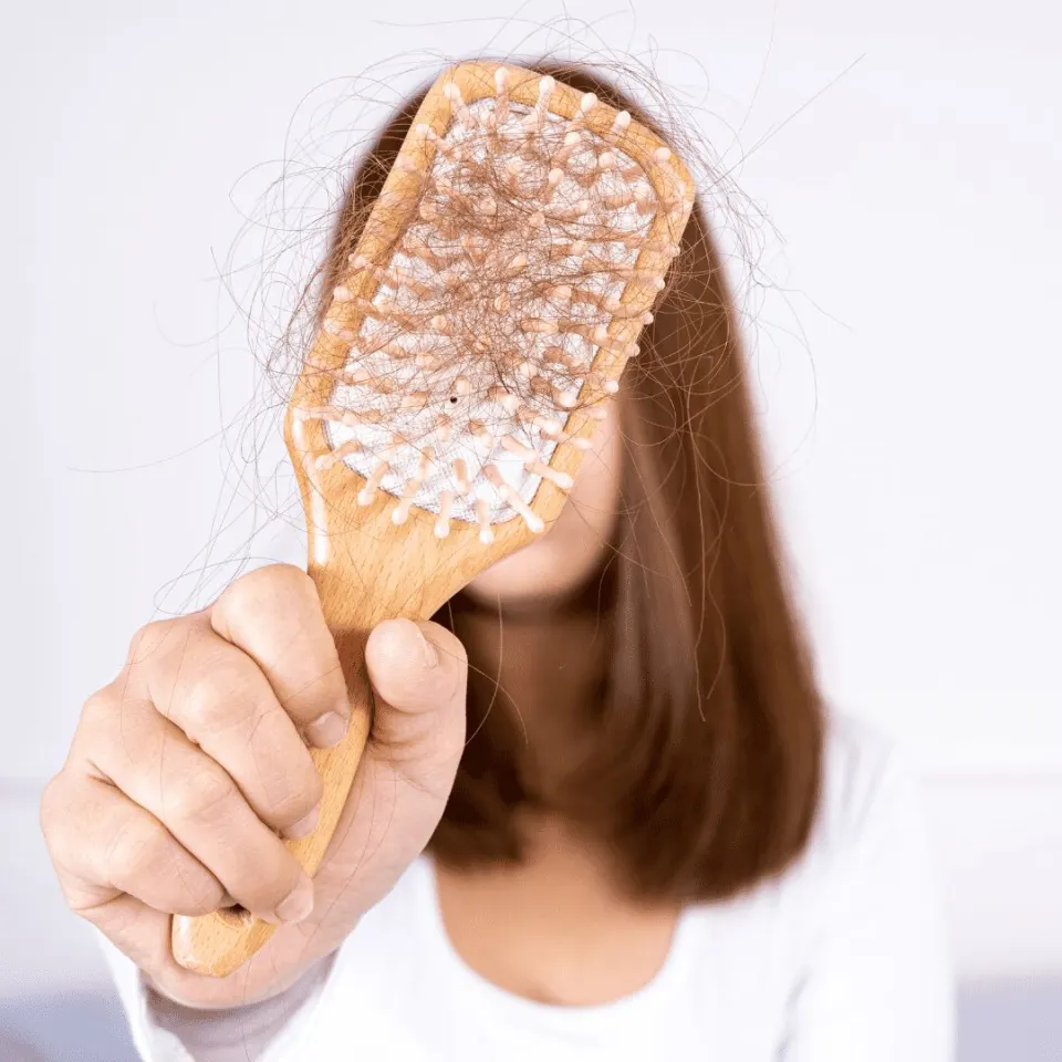 what is female pattern baldness (woman hair loss)