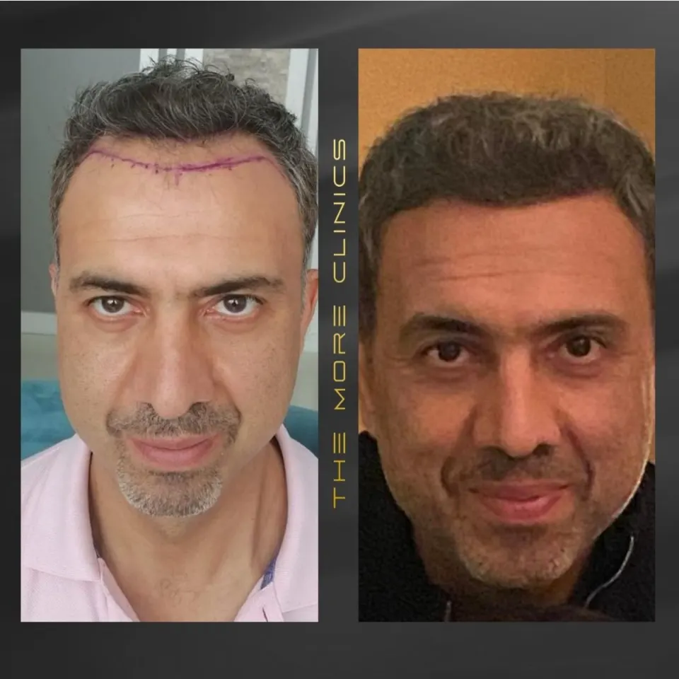 Hair before & after 18