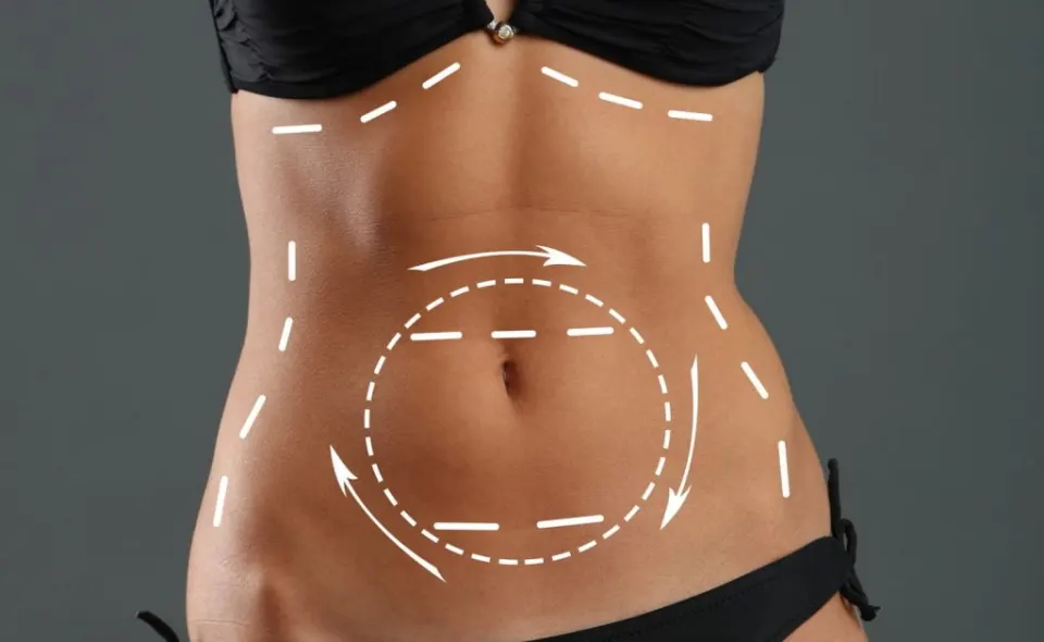 Antalya Liposuction Turkey
