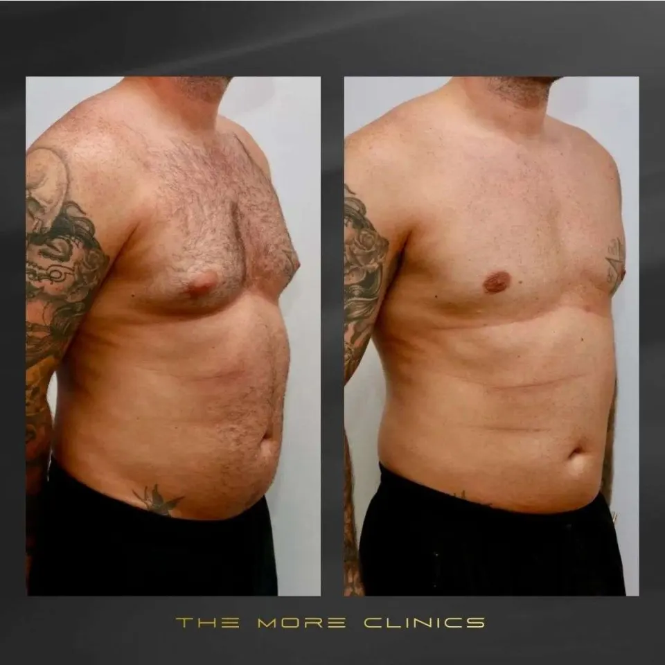 Aesthetic before & after 17