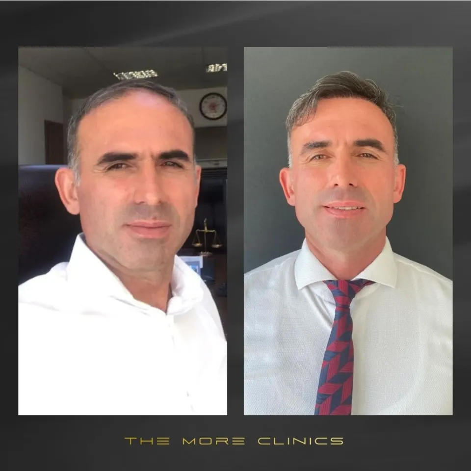 Hair before & after 21