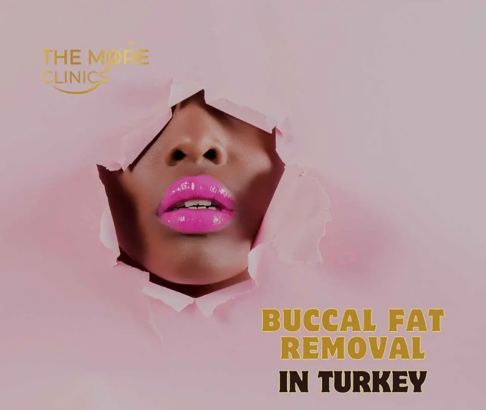best cost of buccal fat removal turkey