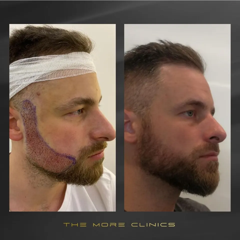 Hair before & after 31
