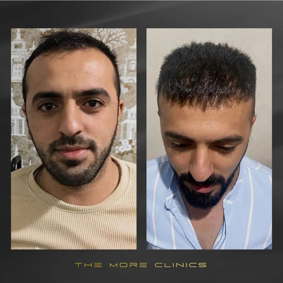 Hair before & after 17