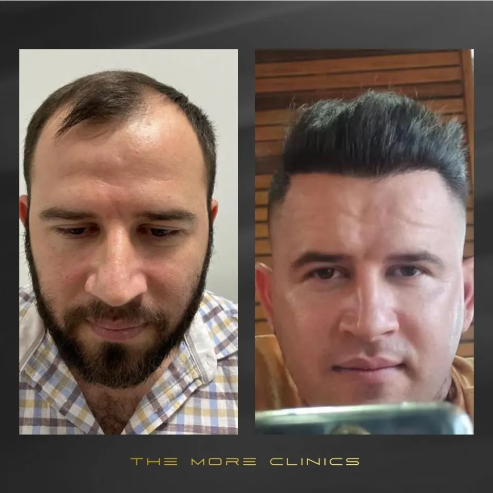 Hair before & after 8