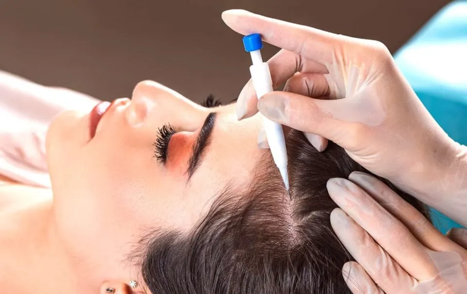 Hair transplant for women in Turkey — no-shave DHI, cost and before after results 2026